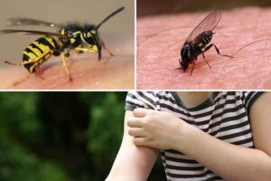 como-evitar-picaduras-y-mordeduras- de-insectos