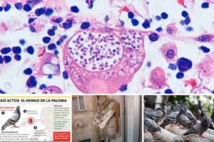 como-se-transmite-la-histoplasmosis-de-las-palomas